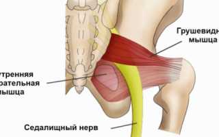 Схема медикаментозного лечения синдрома грушевидной мышцы