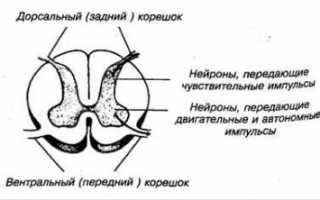Остеохондроз с болевым корешковым синдромом лечение