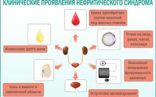 Разница нефритический и нефротический синдром