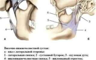 Сустав нижней челюсти воспаление синдром