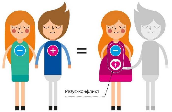 Синдром развития плода 1 степени