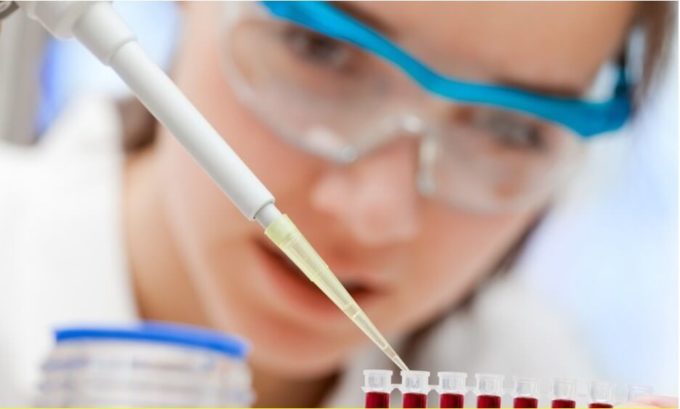 antitela_k_fosfolipidam_test Анализ крови по антифосфолипидному синдрому