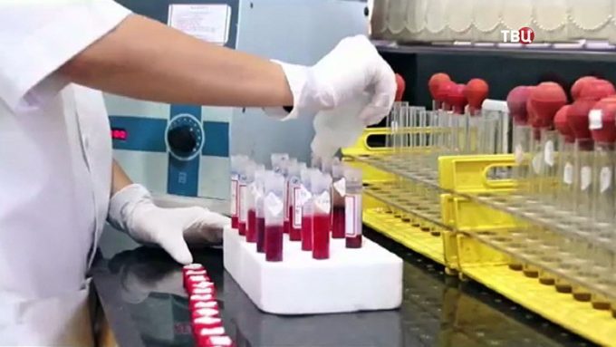 rfmk_diagnostika Показатели рфмк при двс синдроме