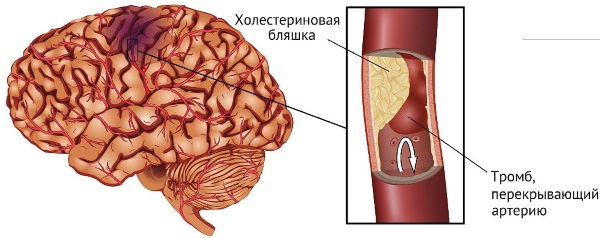 Тяжело дышать, не хватает воздуха. Причины, что делать, лечение