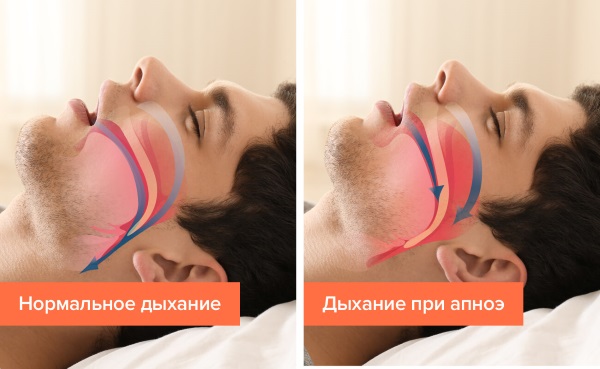 Тяжело дышать, не хватает воздуха. Причины, что делать, лечение