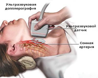 Ультразвуковая допплерография Ультразвуковая допплерография